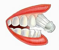 Zahnarzt in Basel erklärt das Zähneputzen