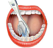 Zahnarzt in Basel erklärt das Zähneputzen - 2.Schritt